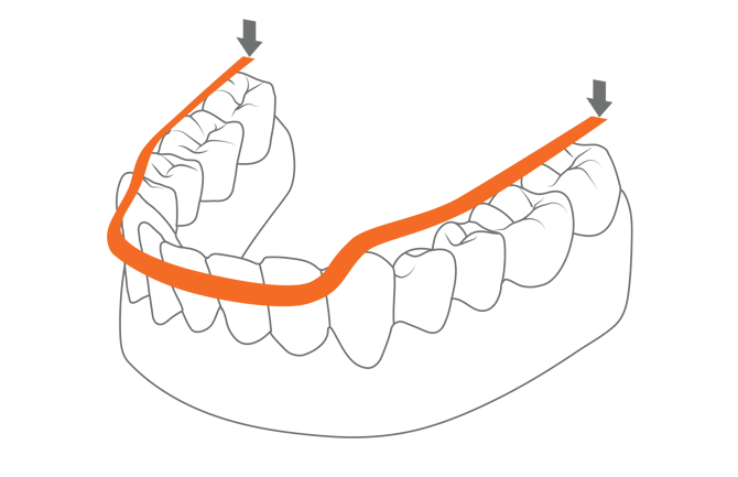 Teeth Scan Path Illustrations-11