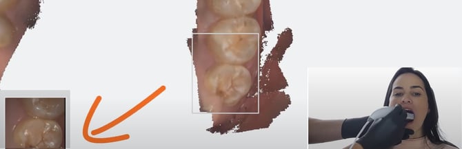 before-you-scan-4
