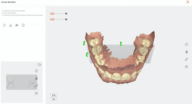 ezgif-2b45f802b4bd0a39
