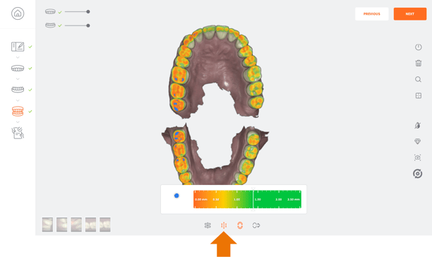 occlusal-map